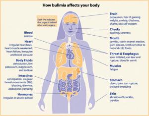 im_bulimia_affects